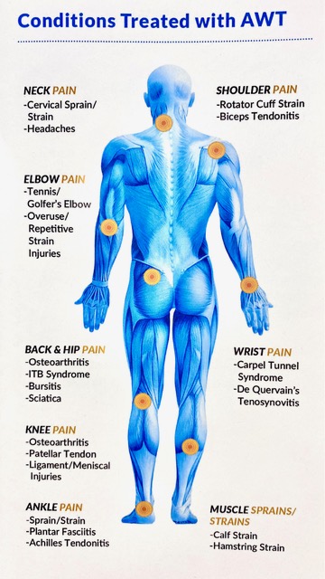 Acoustic Wave Therapy in Palm Springs - Palm Springs Chiropractic ...